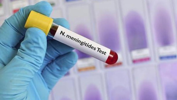 Asl,meningite non è causa decesso Napoli