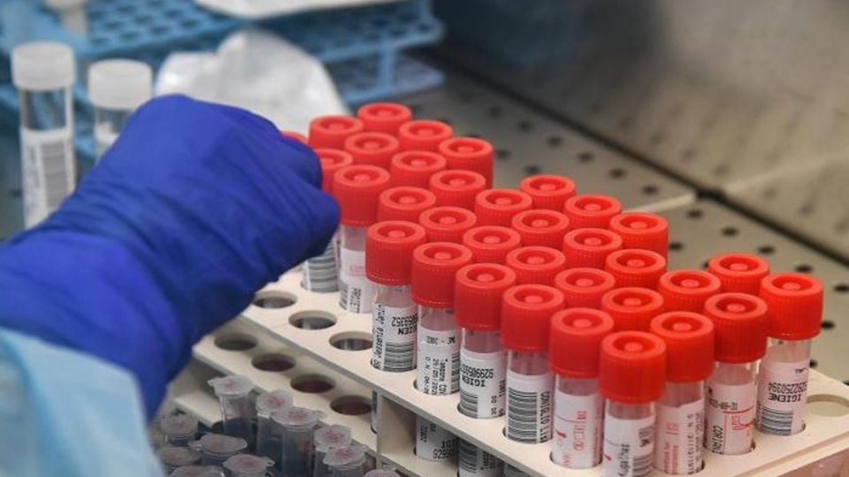 Covid a Como, i dati reali sono 5 volte di più di quelli ufficiali Covid a Como, i dati reali sono 5 volte di più di quelli ufficiali