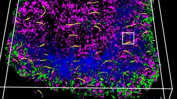 Modelli cyborg del pancreas controllano le fabbriche di insulina