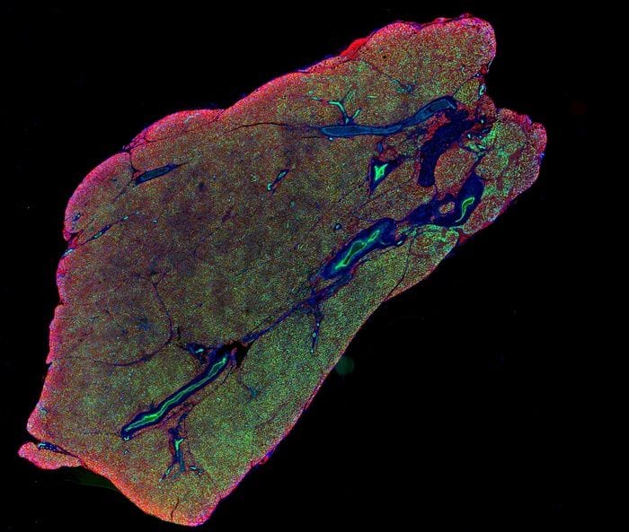 Individuato il meccanismo che attiva il tessuto bruciagrassi 