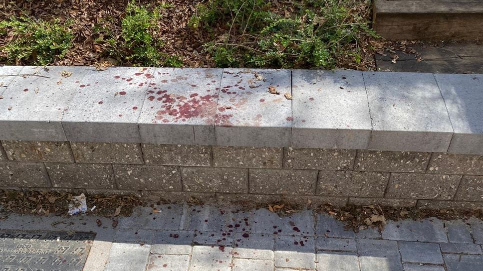 Rissa notturna davanti alla scuola. Giovane in ospedale con il naso rotto