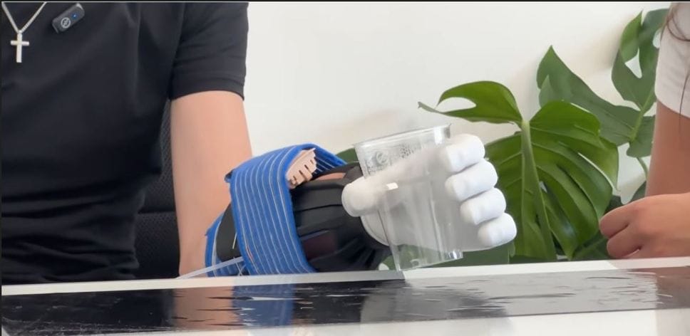 Nuova mano dopo l’esplosione del petardo: via alla raccolta fondi per il sedicenne
